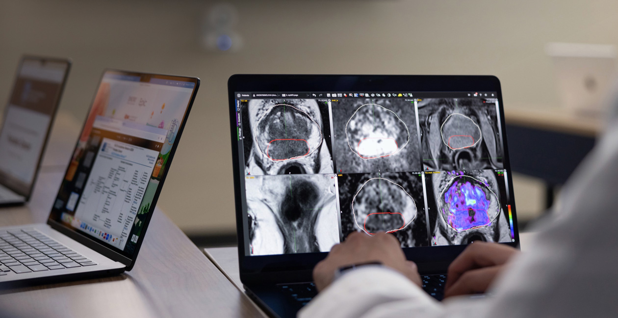 MacBook Pro exibindo imagens de radiologia.